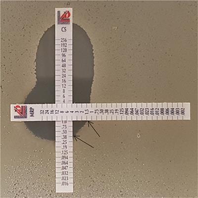 In vitro Evaluation of the Colistin-Carbapenem Combination in Clinical Isolates of A. baumannii Using the Checkerboard, Etest, and Time-Kill Curve Techniques